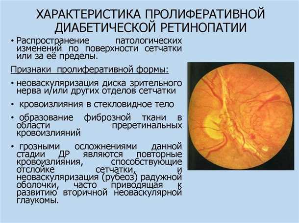 Избегание курения и алкоголя
