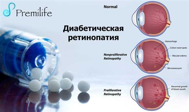 2. Ограничить потребление алкоголя