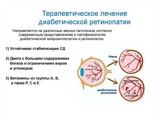 Использование противодиабетических препаратов