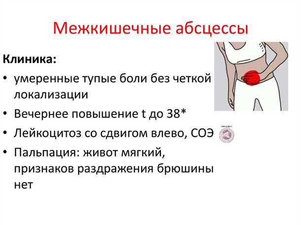 Инфекция крови
