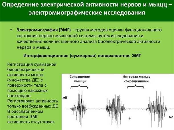 Эффективность и точность диагностики невритов и невропатий с использованием электромиографии и нейрографии