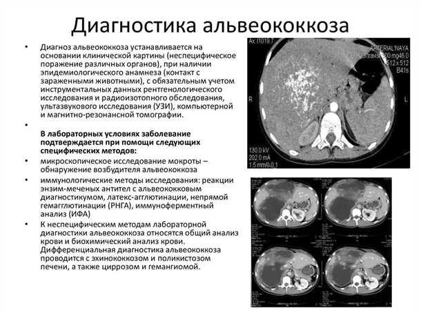 1. Гигиена рук
