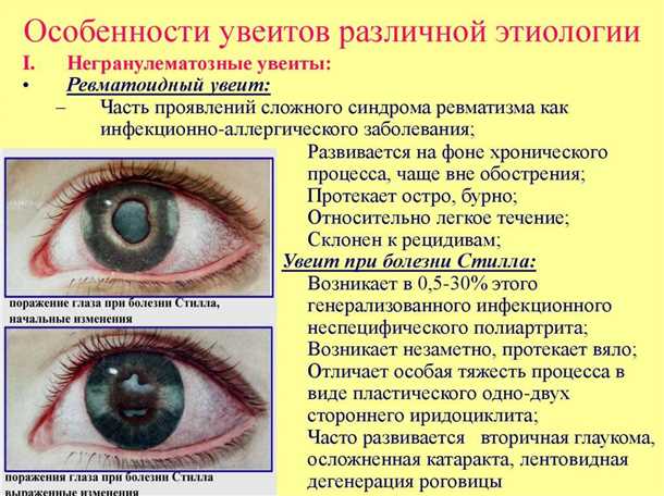 Блокирование здорового глаза