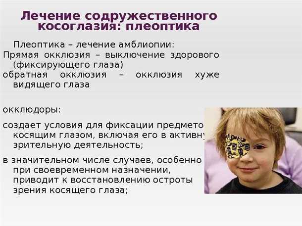 Амблиопия или ленивый глаз, симптомы, лечение. Все о глазных болезнях.