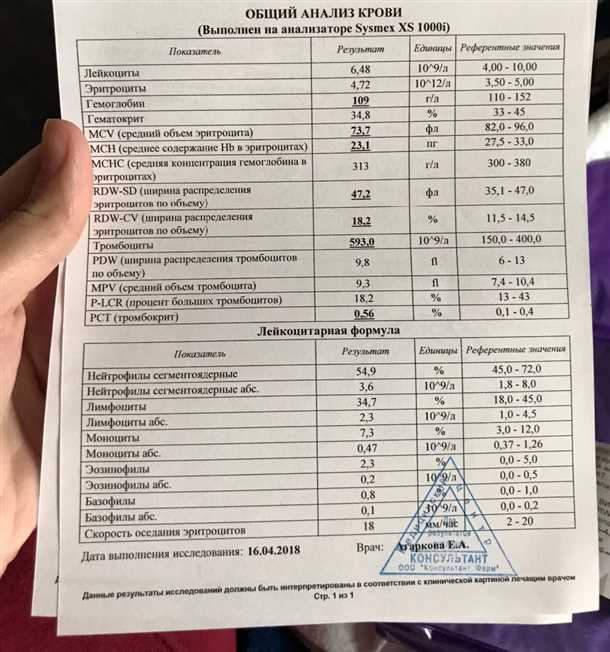 Часто задаваемые вопросы о анализе крови на непереносимость продуктов