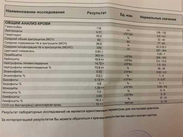 Воспаление десен