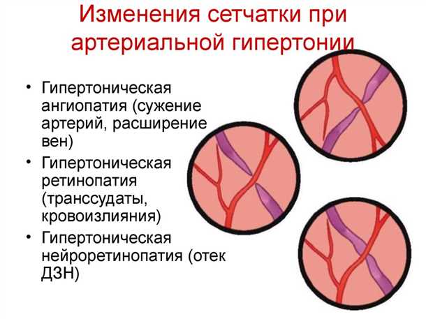 Диагностика ангиопатии сетчатки