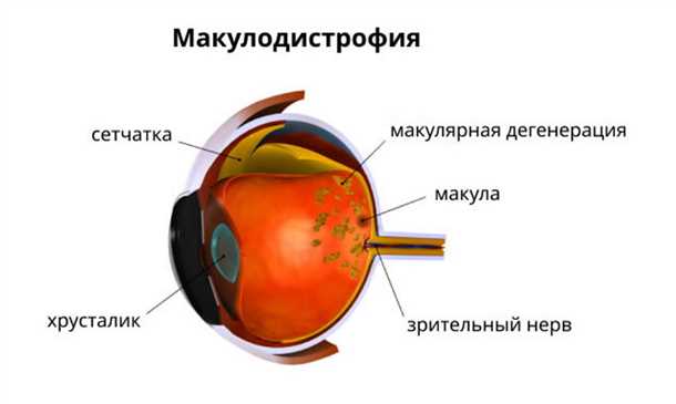Существующие методы лечения