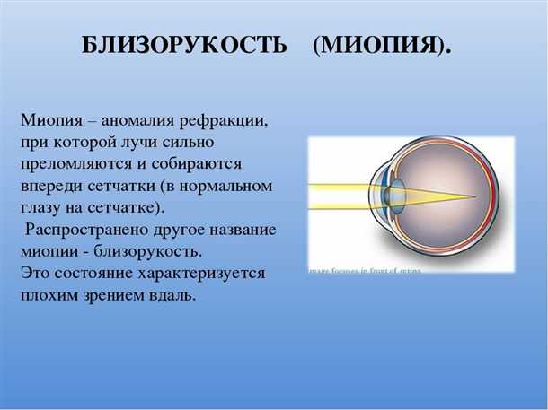 Современные технологии в лечении близорукости