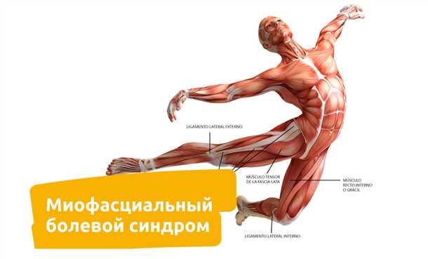 Симптомы и проявления миофасциального синдрома
