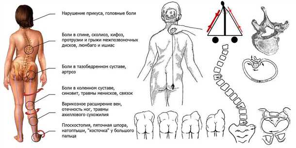 Методы физической реабилитации