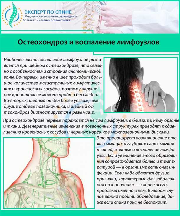 Роль и структура лимфатической системы в организме