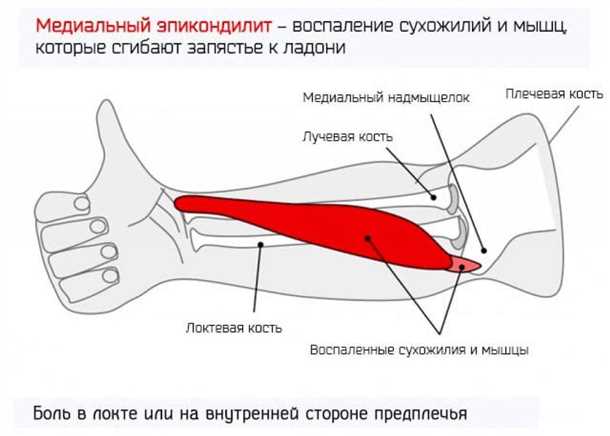 Заключение