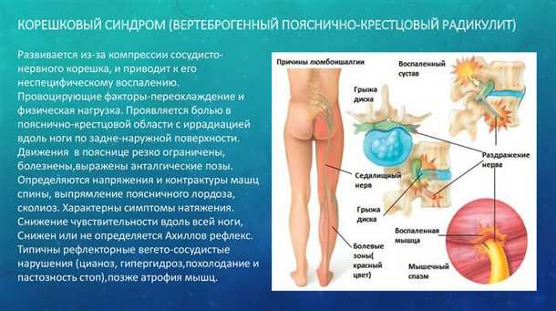 Рентгенография и магнитно-резонансная томография: ключевые методы диагностики позвоночных грыж
