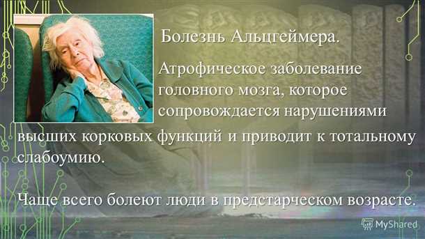 Болезнь Альцгеймера