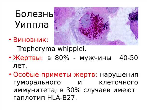 Укрепление иммунной системы