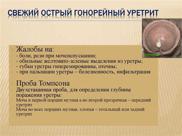 Боли в области мочеиспускательного канала: причины и методы облегчения.
