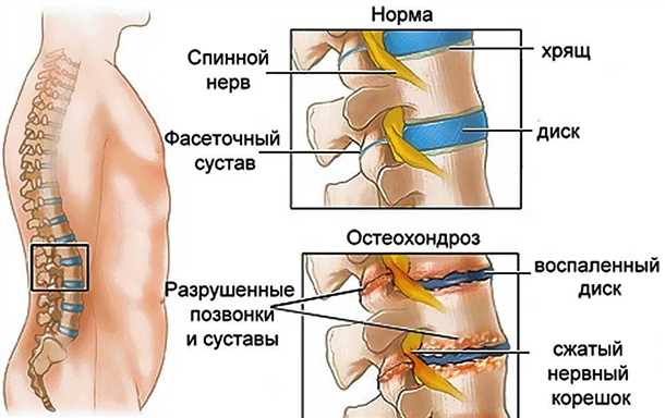 Диагностические методы для выявления причин неприятных ощущений в спине у молодых пациентов