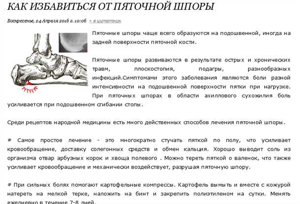 Взаимосвязь между соединительными тканями и возникновением боли в стопе