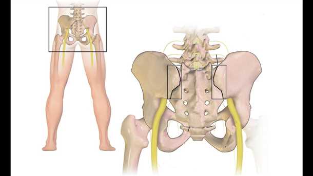 Патологические изменения, вызывающие боль в тазовых костях