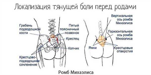 Боли в области тазовых костей и крестца. Как провести дифференциальный диагноз и выбрать эффективное лечение для ощутимого облегчения Боли в области тазовых костей и крестца: дифференциальный диагноз и лечение.