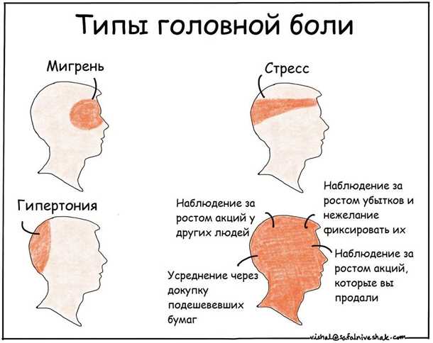 Методы облегчения мигрени