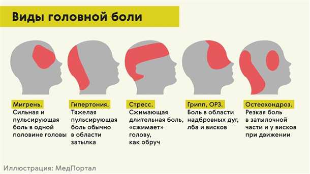 Боли в области теменной части головы: причины и подходы к лечению.