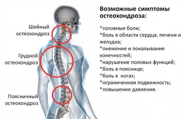Возможные варианты изменения рабочих привычек для уменьшения дискомфорта в области шеи