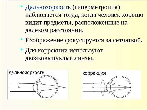 1. Легкая дальнозоркость