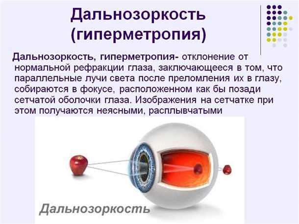 Определение и причины