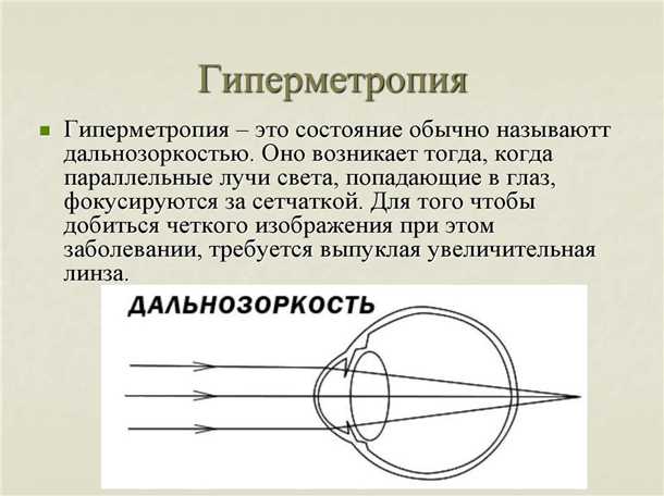 Что такое дальнозоркость и как определить степень дальнозоркости - подробный обзор гиперметропии Что такое дальнозоркость (гиперметропия), степени дальнозоркости.