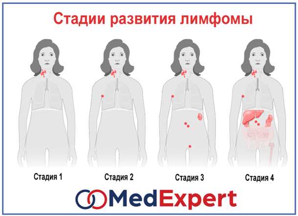 Анамнез и физическое обследование