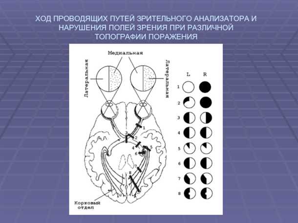 Профилактика проблем с зрительным путем