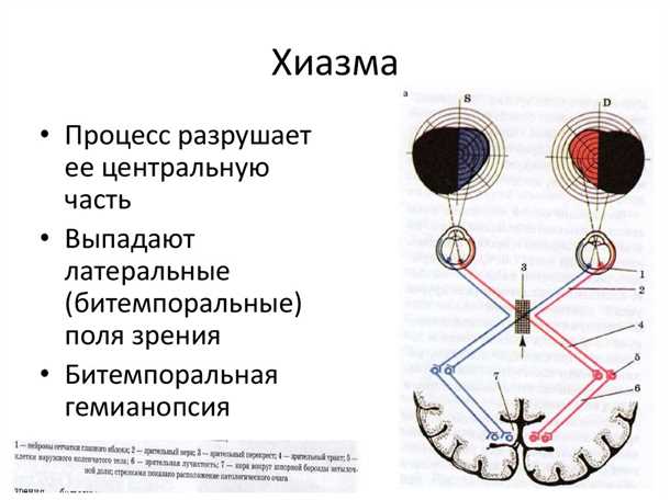 2. Регулярные упражнения для глаз