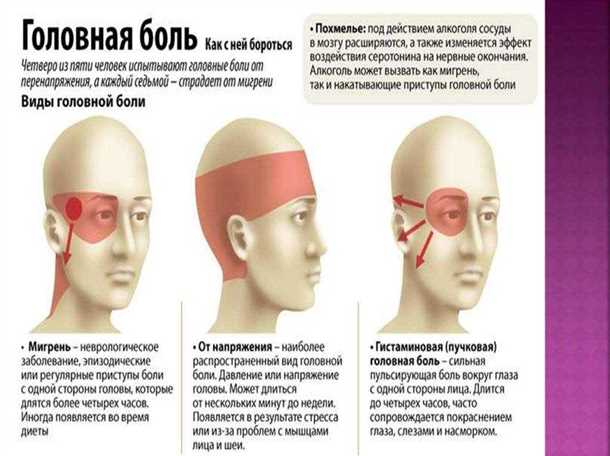 2. Расслабляющие упражнения для глаз