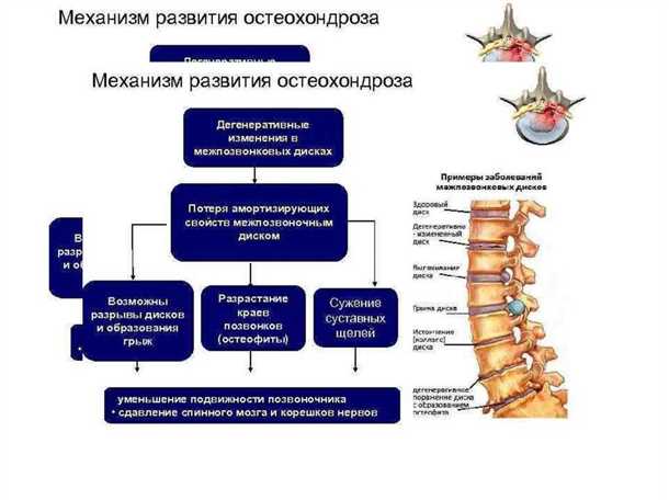 Возможные факторы, способствующие развитию дегенеративных изменений позвоночника