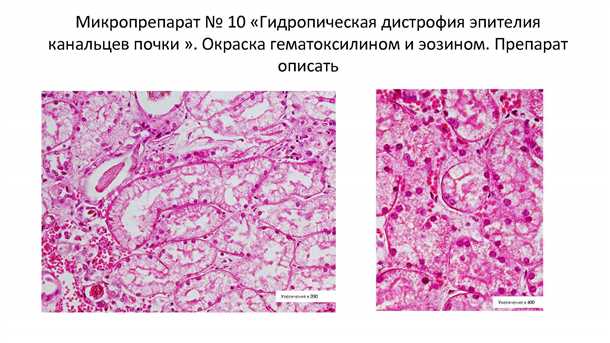 Факторы, способствующие возникновению дегенерации хрящевой ткани