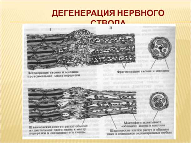 Дегенерация диаметровой хрящевой ткани (ДДХТ) и ее последствия.