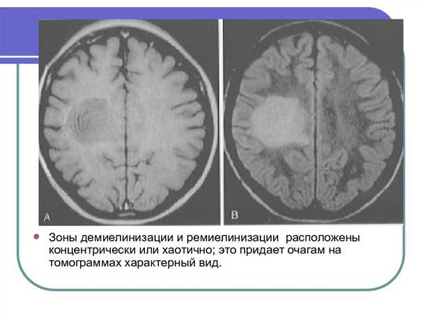 2. Дисфункция метаболических путей