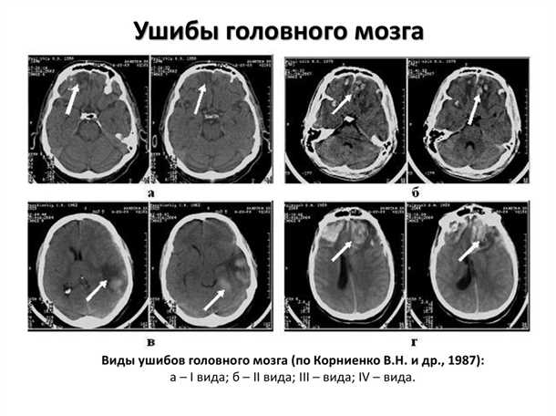 Психологические последствия