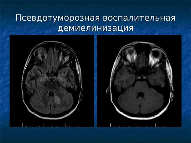 Клинические исследования