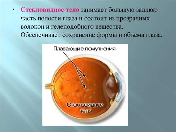 Рекомендации по профилактике деструкции стекловидного тела