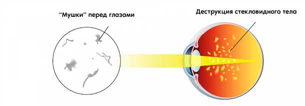 3. Соблюдайте гигиену глаз