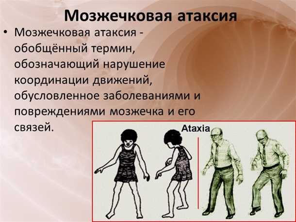 1. Грубая и неустойчивая походка