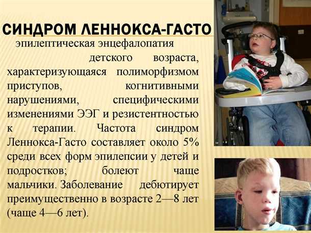 Детский миелопатический синдром.