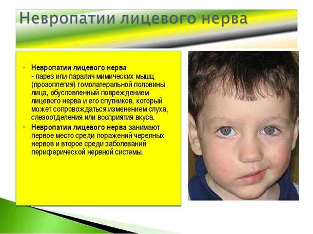 Лечение расстройств моторики лица