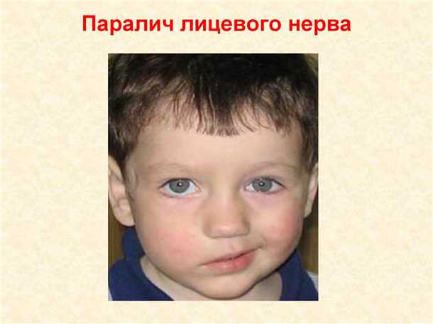Медикаментозное лечение