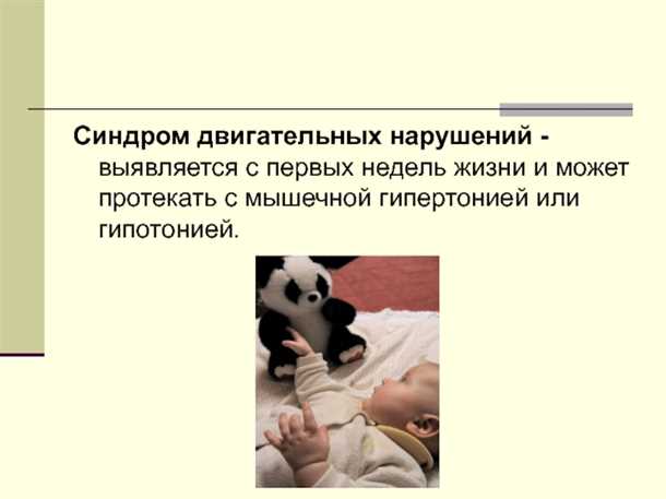 Роль родителей в ранней диагностике и лечении детского синдрома нарушений двигательных навыков