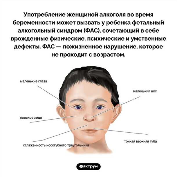 Симптомы, сопровождающие детский синдром нарушений координации глаз и рук