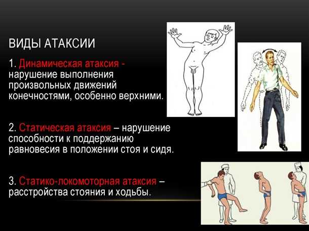 Понятие и симптомы детского синдрома координационных нарушений